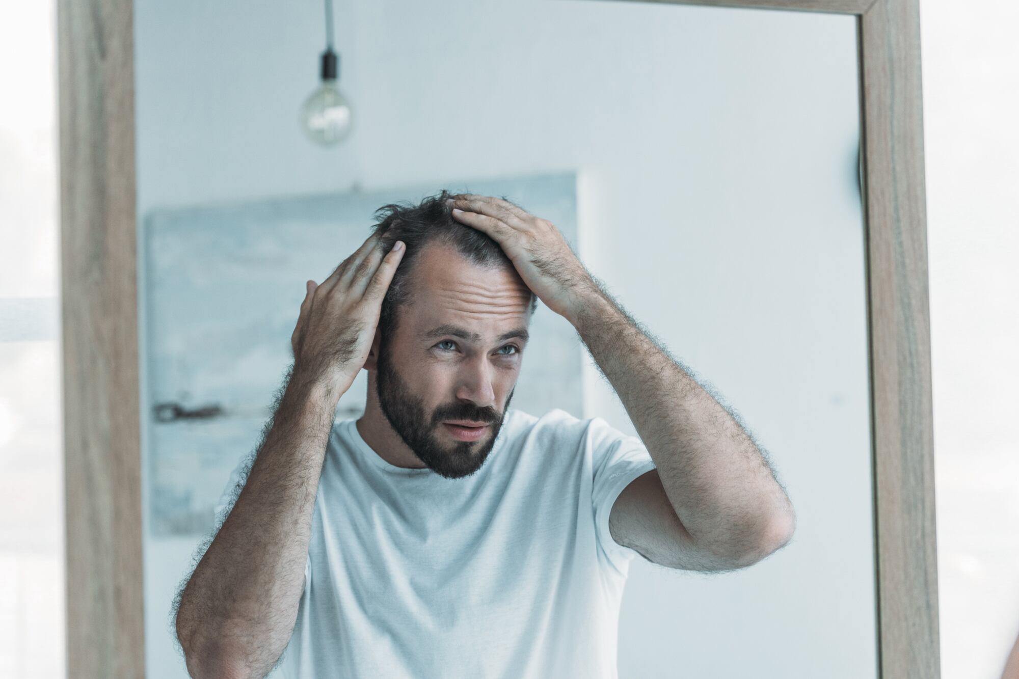 calvicie:-la-molecula-que-“despierta”-foliculos-dormidos-y-podria-regenerar-el-crecimiento-del-pelo